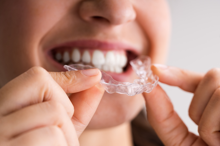 Orthodontic Solutions for Adults: It’s Never Too Late for a Straighter Smile